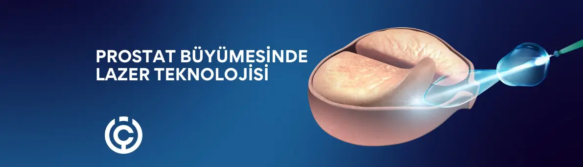 omur cerci (3)