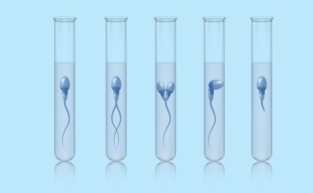 sperm-test,